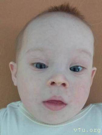 Солнышки, не лишние... - abj9v-6c3k.jpg