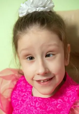  Сделай шаг - дети с тем самым диагнозом - anh3b-mba6.webp