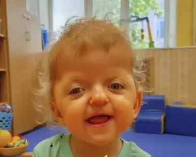 Детки с патологиями конечностей. - cw8s7-jow0.webp