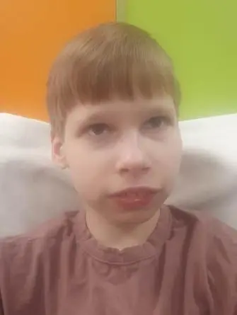 Дети с опорно-двигательным - 9fxi4-5gha.webp