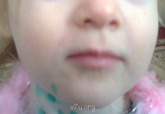 Девочка 3,3 года говорит несколько слов. Это нормально? - Image061911.jpg