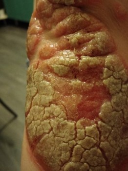 Органическое расстройство личности - IMG_20180901_205736 (1).jpg