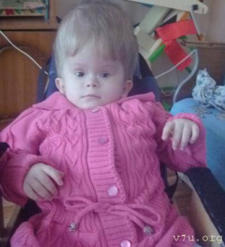  Сделай шаг - дети с тем самым диагнозом - af1ov-4kuw.jpg