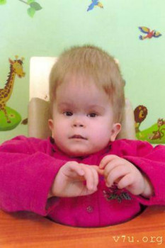  Сделай шаг - дети с тем самым диагнозом - af1ov-4kuw.jpg