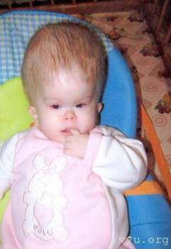  Сделай шаг - дети с тем самым диагнозом - af1ov-4kuw.jpg