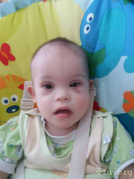 Солнышки, не лишние... - dl00v-dpz6.jpg