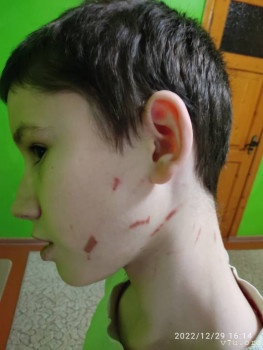 Вопрос у кого обострение у ребёнка или воспитателя?