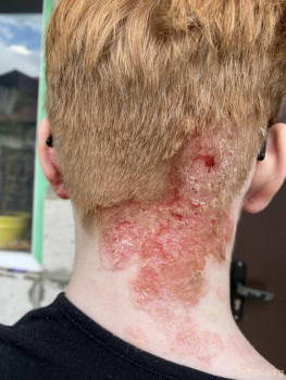 Здесь уже со значительными улучшениями(