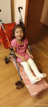 Эквинус- предстоит операция. Чего ожидать? - IMG_20231120_074830.jpg