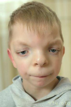 Максим С., май 2016 г рождения из Подмосковья, ждет маму и папу - ceond-fgsg.jpg