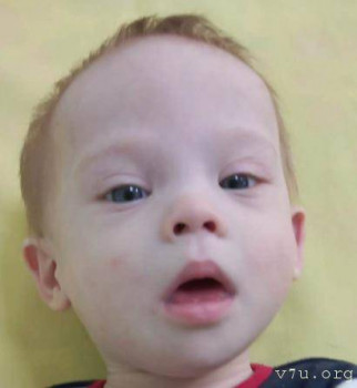 Солнышки, не лишние... - abj9v-6c3k.jpg