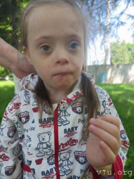 Солнышки, не лишние... - 7zyih-eeth.jpg