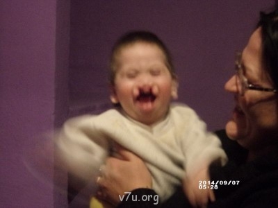 Дом ребёнка не хочет отдать ребёнка- инвалида в приемную сем - GEDC0308.JPG