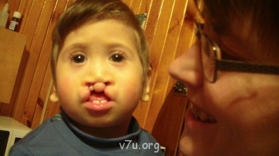 Дом ребёнка не хочет отдать ребёнка- инвалида в приемную сем - SAM_1403.JPG