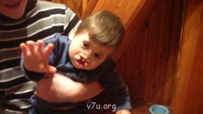 Дом ребёнка не хочет отдать ребёнка- инвалида в приемную сем - SAM_1413.JPG