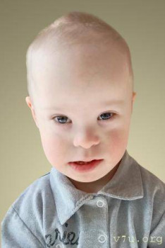 Солнышки, не лишние... - 88k8h-bm0w.jpg