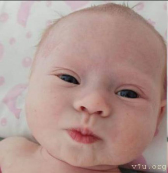 Солнышки, не лишние... - изображение.jpg