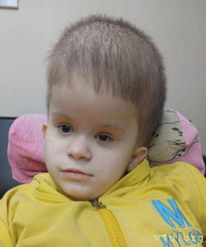  Сделай шаг - дети с тем самым диагнозом - af1ov-4kuw.jpg