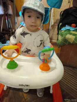 Операция при птозе двустороннем - IMG_20250531_180800.jpg