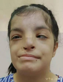  Сделай шаг - дети с тем самым диагнозом - image.jpg