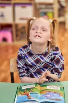 Детки с патологиями конечностей. - czr77-26ump.webp