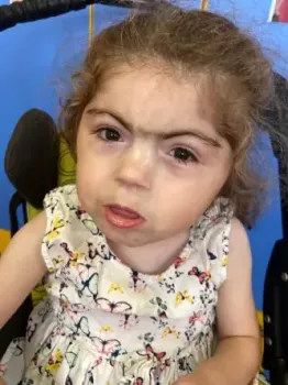 Детки с патологиями конечностей. - ajscr-tim8.webp