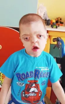 Детки с патологиями конечностей. - dd3l3-n0u8.webp