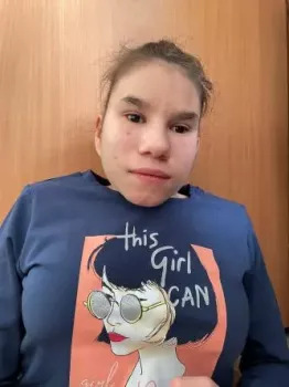  Сделай шаг - дети с тем самым диагнозом - 8uv00-f44i.webp