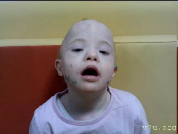 Солнышки, не лишние... - изображение.jpg