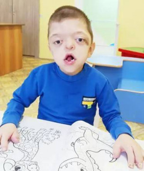 Детки с патологиями конечностей. - изображение.jpg