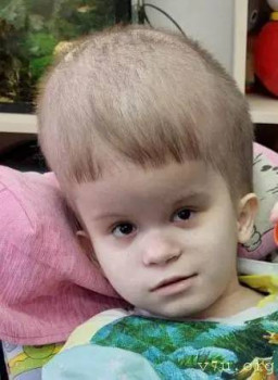  Сделай шаг - дети с тем самым диагнозом - изображение.jpg