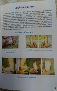 Наш Зайка - _20161106_175603.JPG