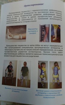 Наш Зайка - _20161106_175527.JPG