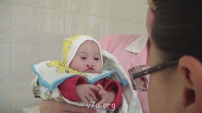 Дом ребёнка не хочет отдать ребёнка- инвалида в приемную сем - SAM_1047.JPG