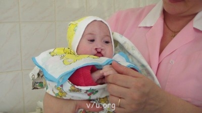 Дом ребёнка не хочет отдать ребёнка- инвалида в приемную сем - SAM_1051.JPG