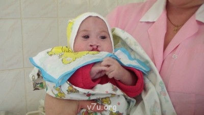 Дом ребёнка не хочет отдать ребёнка- инвалида в приемную сем - SAM_1052.JPG